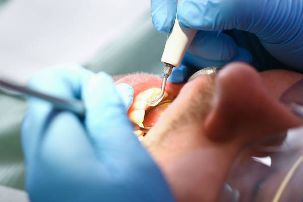Best Orthodontic Emergency Dentist in Matthews, NC