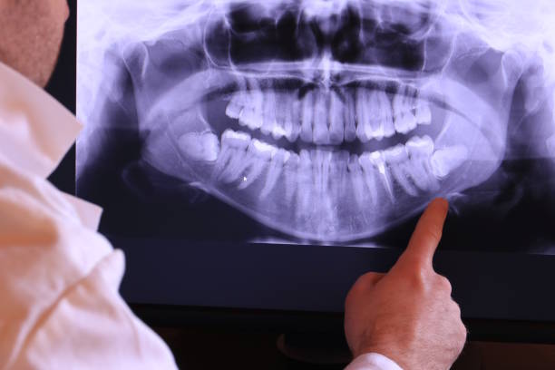  Matthews, NC Emergency Dentist Pros