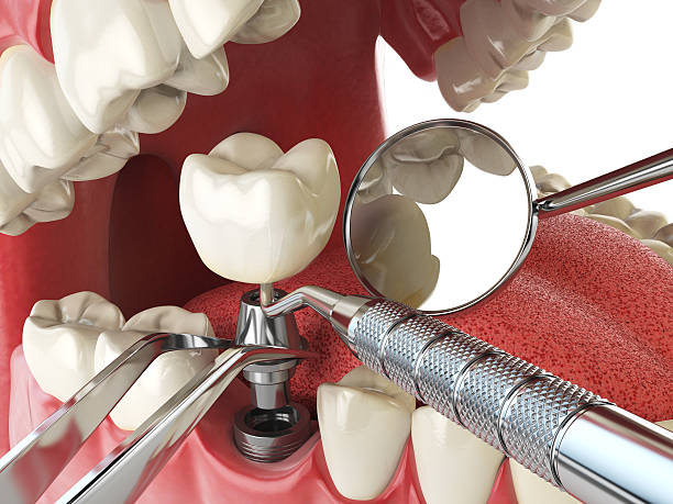 Best Emergency Dental Services for Seniors in Matthews, NC